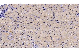 Immunohistochemistry (IHC) image for anti-Nuclear Factor of kappa Light Polypeptide Gene Enhancer in B-Cells Inhibitor, alpha (NFKBIA) (AA 74-247) antibody (ABIN7434194)