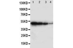 Lane 4: Recombinant Human BMPR1B Protein 1.