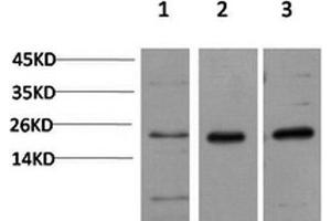 Western Blot analysis of 1) Hela, 2)3T3, 3) PC-12 cells using CBX5 Monoclonal Antibody at dilution of 1:1000. (CBX5 antibody)