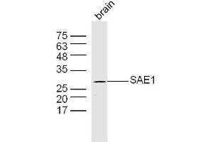Mouse brain lysates probed with SAE1 Polyclonal Antibody, Unconjugated  at 1:300 dilution and 4˚C overnight incubation. (SAE1 antibody  (AA 1-100))