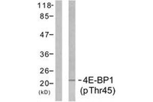 Western blot analysis of extracts from MDA-MB-435 cells treated with EGF 200ng/ml 5', using 4E-BP1 (Phospho-Thr45) Antibody. (eIF4EBP1 antibody  (pThr46))