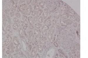 Sample Type:  Human KidneyPrimary   Dilution:  1ug/mL (MSH2 antibody  (N-Term))