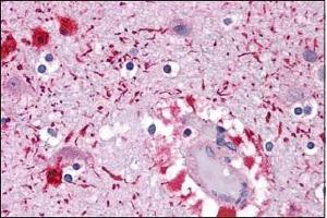 Immunohistochemistry PIWI-L2 in Human brain tissue with PIWIL2 Antibody  at 5 μg/ml. (PIWIL2 antibody  (Middle Region))