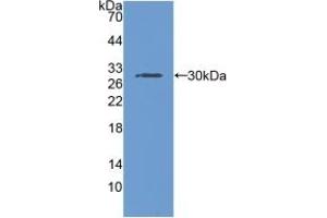 Detection of Recombinant RNPEP, Human using Polyclonal Antibody to Aminopeptidase B (RNPEP) (RNPEP antibody  (AA 388-616))