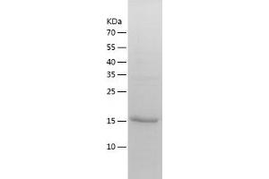 Western Blotting (WB) image for Acireductone Dioxygenase 1 (ADI1) (AA 1-179) protein (His tag) (ABIN7288619) (ADI1 Protein (AA 1-179) (His tag))