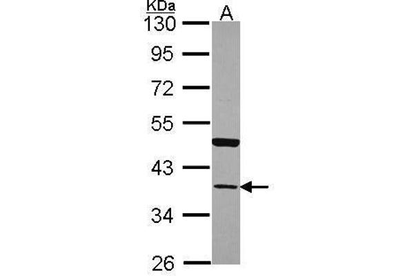 Annexin A13 anticorps  (N-Term)