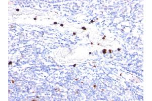 Formalin-fixed, paraffin-embedded human Tonsil stained with Cystatin A Mouse Monoclonal Antibody (CPTC-CSTA-1). (CSTA antibody)
