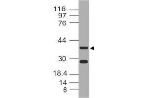Image no. 1 for anti-Leucine-Rich alpha-2 Glycoprotein 1 (LRG1) (AA 130-340) antibody (ABIN5027334) (LRG1 antibody  (AA 130-340))