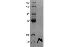 Validation with Western Blot