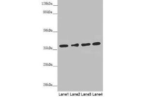 Western blot All lanes: ERLIN2 antibody at 3. (ERLIN2 antibody  (AA 212-339))