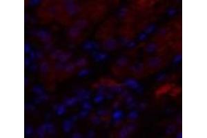 Immunofluorescence analysis of Human kidney tissue using IL8 Polyclonal Antibody at dilution of 1:200. (IL-8 antibody)