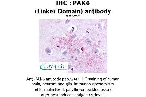 Image no. 1 for anti-P21-Activated Kinase 6 (PAK6) antibody (ABIN1737839) (PAK6 antibody)