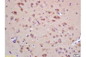 Formalin-fixed and paraffin embedded rat brain labeled with Rabbit Anti CHRNB2 Polyclonal Antibody, Unconjugated (ABIN705836) at 1:200 followed by conjugation to the secondary antibody and DAB staining