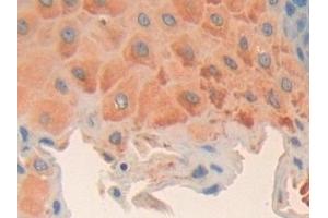 Detection of CCND2 in Human Esophagus Tissue using Polyclonal Antibody to Cyclin D2 (CCND2) (Cyclin D2 antibody  (AA 68-278))