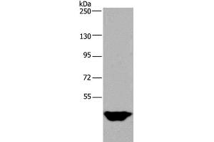 Western Blot analysis of Human testis tissue using MTF2 Polyclonal Antibody at dilution of 1:400 (MTF2 antibody)