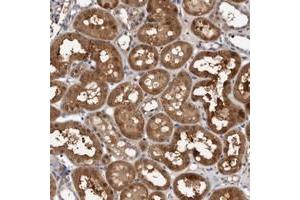 Immunohistochemical staining of human kidney with C6orf108 polyclonal antibody  shows strong cytoplasmic positivity in tubular cells. (RCL antibody)
