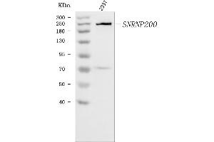 Western blot analysis of SNRNP200 using anti-SNRNP200 antibody (ABIN7602032). (SNRNP200 antibody  (AA 557-2129))
