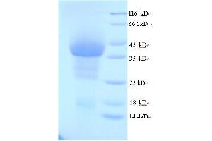 SDS-PAGE (SDS) image for Polymerase (DNA Directed), gamma (POLG) (AA 575-866) protein (His tag) (ABIN4976675) (POLG Protein (AA 575-866) (His tag))