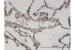 Immunoperoxidase of monoclonal antibody to ZNF192 on formalin-fixed paraffin-embedded human lung. (ZNF192 antibody  (AA 1-90))