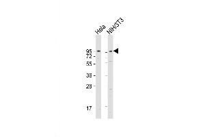 Western Blot at 1:1000-1:2000 dilution Lane 1: Hela whole cell lysate Lane 2: NIH/3T3 whole cell lysate Lysates/proteins at 20 ug per lane. (Dystroglycan antibody  (C-Term))
