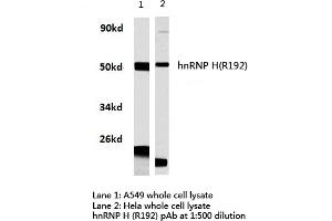 Western blot (WB) analysis of hnRNP H antibody in extracts from hela and A549 cells.