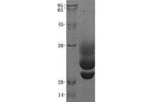 Validation with Western Blot (CD83 Protein (CD83) (Transcript Variant 2) (His tag))