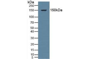 Western blot analysis of Human Blood Cells. (NR3C2 antibody  (AA 739-984))