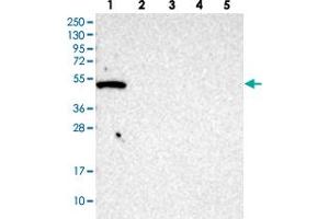 Western blot analysis of Lane 1: RT-4, Lane 2: U-251 MG, Lane 3: human plasma, Lane 4: liver, Lane 5: tonsil GTPBP10 polyclonal antibody . (GTPBP10 antibody)