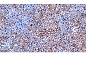 Detection of APOB in Mouse Liver Tissue using Polyclonal Antibody to Apolipoprotein B (APOB) (APOB antibody  (AA 32-306))