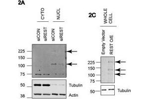 REST antibody - middle region  validated by WB using A549 and HEK293T cells at 1: 500. (REST antibody  (Middle Region))