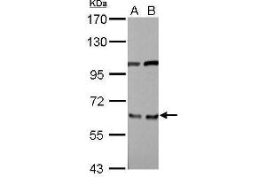 Western Blotting (WB) image for anti-Eukaryotic Translation Initiation Factor 3, Subunit D (EIF3D) antibody (ABIN2855038)