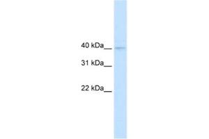 Western Blotting (WB) image for anti-Nudix (Nucleoside Diphosphate Linked Moiety X)-Type Motif 9 (NUDT9) antibody (ABIN2461168) (NUDT9 antibody)