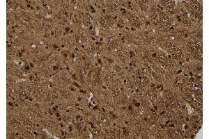 ABIN6277781 at 1/100 staining Rat brain tissue by IHC-P. (Arrestin 3 antibody  (C-Term))