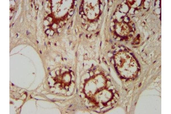 TRAPPC6A antibody  (AA 1-173)
