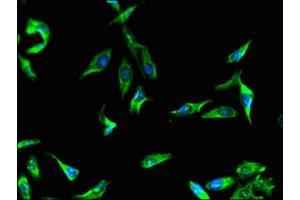 Immunofluorescent analysis of Hela cells using ABIN7165997 at dilution of 1:100 and Alexa Fluor 488-congugated AffiniPure Goat Anti-Rabbit IgG(H+L) (BBS9 antibody  (AA 8-185))