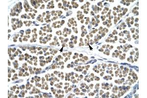 GABRD antibody was used for immunohistochemistry at a concentration of 4-8 ug/ml to stain Skeletal muscle cells (arrows) in Human Muscle. (GABRD antibody  (N-Term))