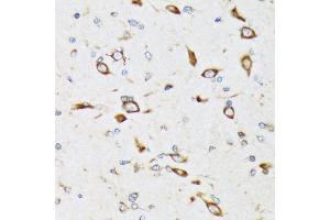 Immunohistochemistry of paraffin-embedded rat brain using RPS20 Rabbit mAb (ABIN7270017) at dilution of 1:100 (40x lens). (RPS20 antibody)