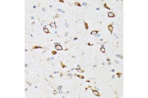Immunohistochemistry of paraffin-embedded rat brain using RPS20 Rabbit mAb (ABIN7270017) at dilution of 1:100 (40x lens).