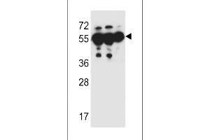 ANKRD57 Antibody (C-term) (ABIN651987 and ABIN2840483) western blot analysis in MDA-M,HepG2,A549 cell line lysates (35 μg/lane). (ANKRD57 antibody  (C-Term))