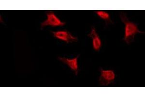 Immunofluorescence (fixed cells) (IF/ICC) image for anti-Ribosomal Protein S3 (RPS3) (Internal Region) antibody (ABIN6257472)