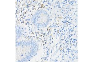 Immunohistochemistry of paraffin-embedded human appendix using CD11a/LFA-1A/ITGAL antibody (ABIN3015541, ABIN3015542, ABIN3015543, ABIN1680526 and ABIN6218728) at dilution of 1:100 (40x lens). (ITGAL antibody  (AA 26-306))