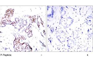 Image no. 1 for anti-ELK1, Member of ETS Oncogene Family (ELK1) (pSer389) antibody (ABIN196678) (ELK1 antibody  (pSer389))