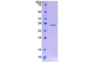SDS-PAGE (SDS) image for Junctophilin 1 (JPH1) (AA 1-201) protein (His tag) (ABIN4989341) (Junctophilin 1 Protein (JPH1) (AA 1-201) (His tag))
