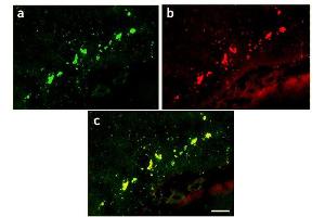 Image no. 1 for anti-Green Fluorescent Protein (GFP) antibody (ABIN346938) (GFP antibody)