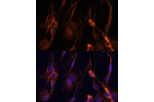 Immunofluorescence analysis of C6 cells using BFAR Polyclonal Antibody (ABIN6127492, ABIN6137542, ABIN6137543 and ABIN6224322) at dilution of 1:100 (40x lens). (BFAR antibody  (AA 1-140))