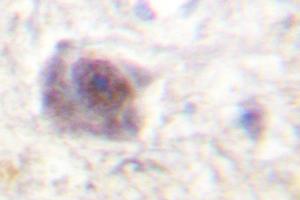 Image no. 1 for anti-Adenomatous Polyposis Coli (APC) antibody (ABIN271993) (APC antibody)