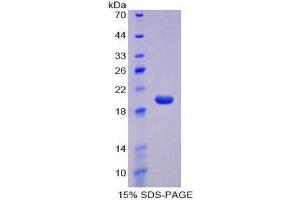 SDS-PAGE (SDS) image for CD160 (CD160) (AA 33-171) protein (His tag) (ABIN2124363)