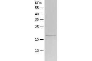 PEBP1 Protein (AA 1-187) (His tag)