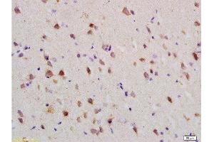 Formalin-fixed and paraffin embedded: rat brain tissue labeled with Anti-Nogo-R Polyclonal Antibody , Unconjugated at 1:200 followed by conjugation to the secondary antibody and DAB staining (RTN4R antibody  (AA 151-350))