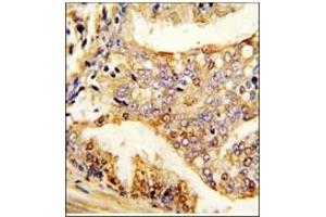 Image no. 1 for anti-Pumilio Homolog 2 (Drosophila) (PUM2) (Ser182) antibody (ABIN360017) (PUM2 antibody  (Ser182))